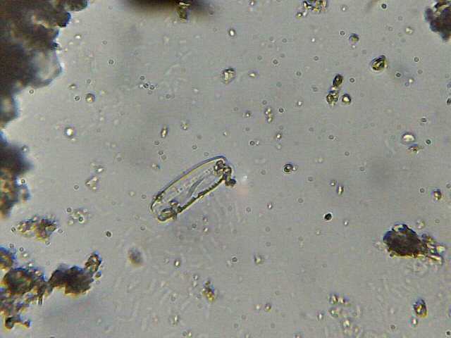 Scheletro di diatomea?